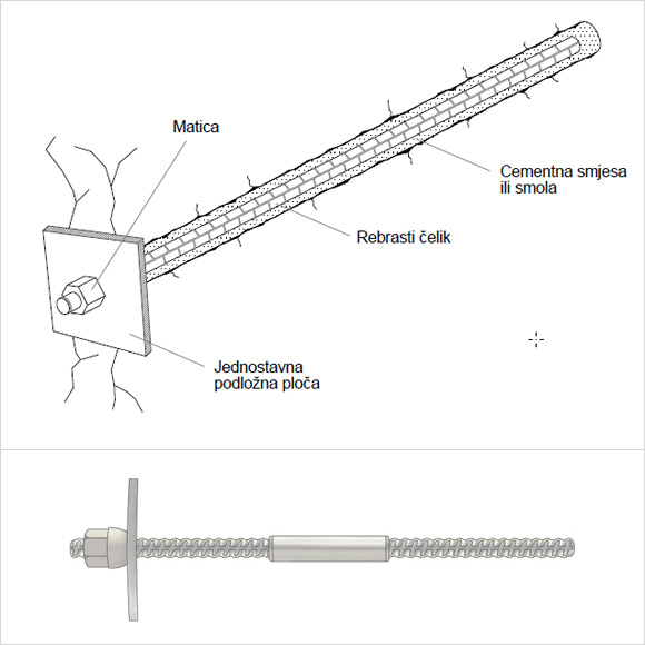 adhezijsko-stapno-sidro